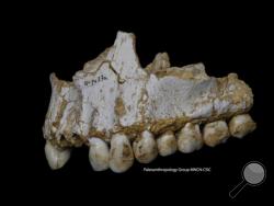 This photo provided by Paleoanthropology Group MNCN-CSIC shows an El Sidron upper jaw: a dental calculus deposit is visible on the rear molar, right, of this Neanderthal. This individual was eating poplar, a source of aspirin, and had also consumed moulded vegetation including Penicillium fungus, source of a natural antibiotic. Scientists got a sneak peek into the kitchen and medicine cabinets of three Neanderthals by examining the DNA of the stuff stuck on and between their teeth. What they found smashes a
