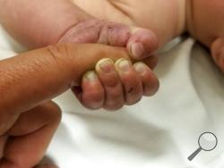 This Sunday, July 8, 2018 photo provided by the Missoula County Sheriff's Office shows a 5-month-old infant with dirt under their fingernails after authorities say the baby survived about nine hours being buried under sticks and debris in the woods. The Missoula County Sheriff's Office says the baby is in good condition at a hospital and calls it a "miracle" that the child survived the weekend ordeal. Authorities say they were called about a man threatening people in the Lolo Hot Springs area of western Mon