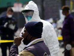 A man swabs his mouths while taking a COVID-19 test in the Skid Row district Monday, April 20, 2020, in Los Angeles. (AP Photo/Marcio Jose Sanchez)