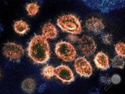 FILE - This 2020 electron microscope image provided by the National Institute of Allergy and Infectious Diseases - Rocky Mountain Laboratories shows SARS-CoV-2 virus particles which cause COVID-19, isolated from a patient in the U.S., emerging from the surface of cells cultured in a lab. According to two new studies released on Tuesday, Dec. 22, 2020, people who have antibodies from infection with the coronavirus seem less likely to get a second infection for several months and maybe longer. (NIAID-RML via 