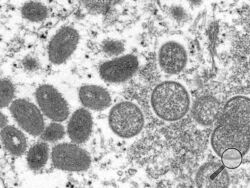 This 2003 electron microscope image made available by the Centers for Disease Control and Prevention shows mature, oval-shaped monkeypox virions, left, and spherical immature virions, right, obtained from a sample of human skin associated with the 2003 prairie dog outbreak. Monkeypox, a disease that rarely appears outside Africa, has been identified by European and American health authorities in recent days. (Cynthia S. Goldsmith, Russell Regner/CDC via AP)