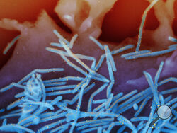 FILE - This electron microscope image provided by the National Institutes of Health shows human respiratory syncytial virus (RSV) virions, colorized blue, and anti-RSV F protein/gold antibodies, colorized yellow, shedding from the surface of human lung cells. Advisers to the Food and Drug Administration on Thursday, May 18, 2023 debated a first-of-its-kind RSV vaccine to protect newborns by immunizing their moms late in pregnancy. (National Institute of Allergy and Infectious Diseases, NIH via AP)