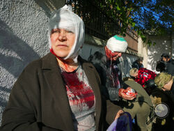 People receive medical treatment at the scene of Russian shelling, in Kyiv, Ukraine, Monday, Oct. 10, 2022. Two explosions rocked Kyiv early Monday following months of relative calm in the Ukrainian capital. (AP Photo/Efrem Lukatsky)