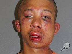 This Friday, July 18, 2014 photo made available by the Volusia County Sheriff's Office, Fla. shows Raymond Frolander, 18. Police say a Daytona Beach father beat Frolander unconscious after finding him sexually abusing his son. (AP Photo/Volusia County Sheriff's Office)