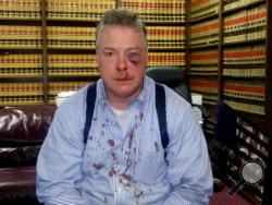 This March 9, 2016 photo provided by Jerry L. Steering shows Defense attorney James Crawford at his attorney's office in Newport Beach, Calif. Crawford an Orange County defense attorney who suffered a bloodied face after a brawl with a district attorney's investigator in a Santa Ana, courthouse hallway.(Jerry L. Steering via AP)