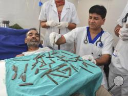 Jatinder Malhotra, right, displays the 40 knives that were surgically removed from the stomach of police constable Surjeet Singh, as he recuperates in a hospital in Amritsar, India, Tuesday, Aug. 23, 2016. A team of two surgeons, two critical care physicians and an anesthetist conducted the surgery during which they initially removed 28 knives and the rest after further investigation revealed 12 more, the hospital said. (AP Photo/ Prabhjot Gill)