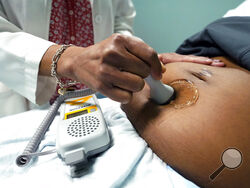 FILE - A doctor uses a hand-held Doppler probe on a pregnant woman to measure the heartbeat of the fetus on Dec. 17, 2021, in Jackson, Miss. COVID-19 drove a dramatic increase in the number of women who died from pregnancy or childbirth complications in the U.S. last year, a crisis that has disproportionately claimed Black and Hispanic women as victims, according to a report released Wednesday, Oct. 19, 2022. (AP Photo/Rogelio V. Solis, File)