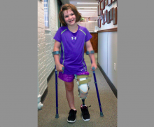 This photo released Thursday, Aug. 15, 2013, by the Richard family shows Jane Richard, 7, who lost part of her left leg in the Boston Marathon bombings on April 15, 2013, walking on a prosthetic leg in Boston. The family of Jane and her late brother Martin, 8, who was killed by one of the blasts, said in a statement that the little girl is already dancing on her prosthetic leg and “struts around on it with great pride.” (AP Photo/Richard Family) 